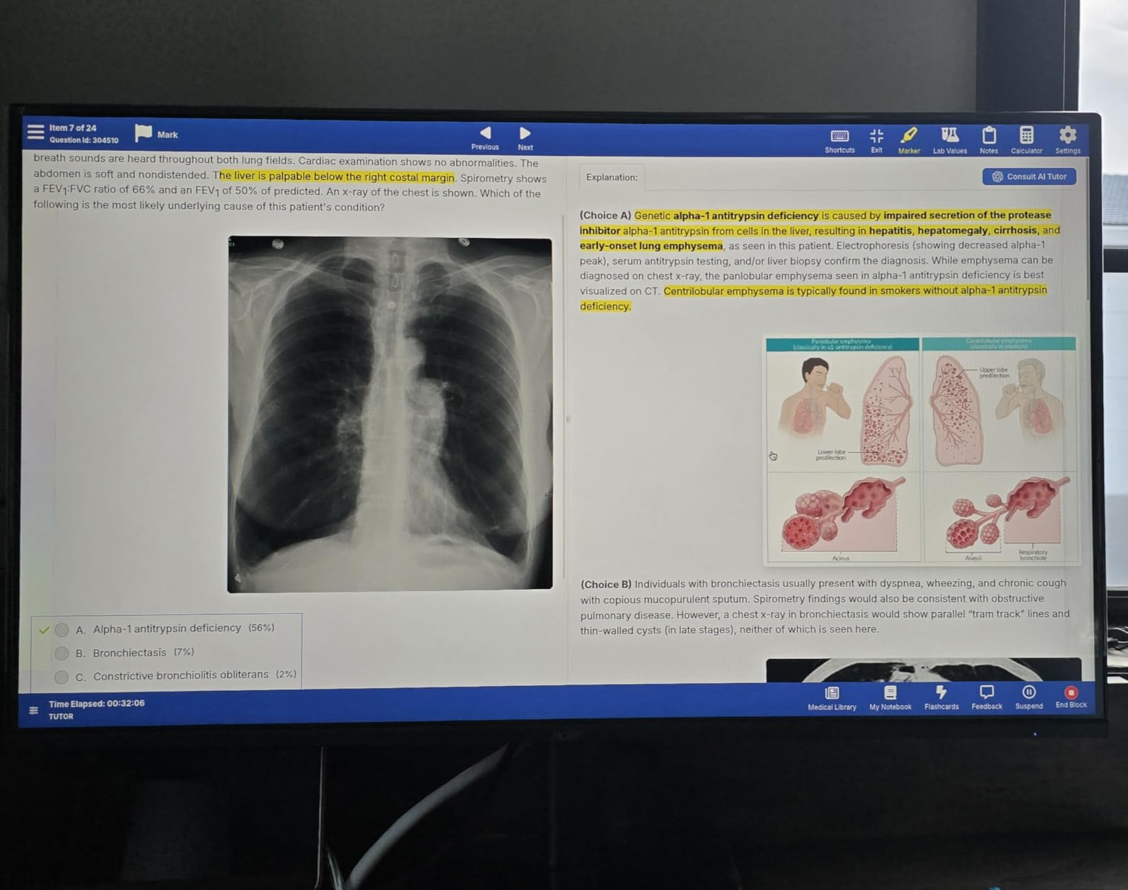 Acer 27in FHD 1920x1080 IPS 120Hz Gaming Monitor | Office KB272 G0bi | 1ms, AdaptiveSync, sRGB 99%, HDMI, VGA, VESA Mountable, Bluelight Filter customer photo 2
