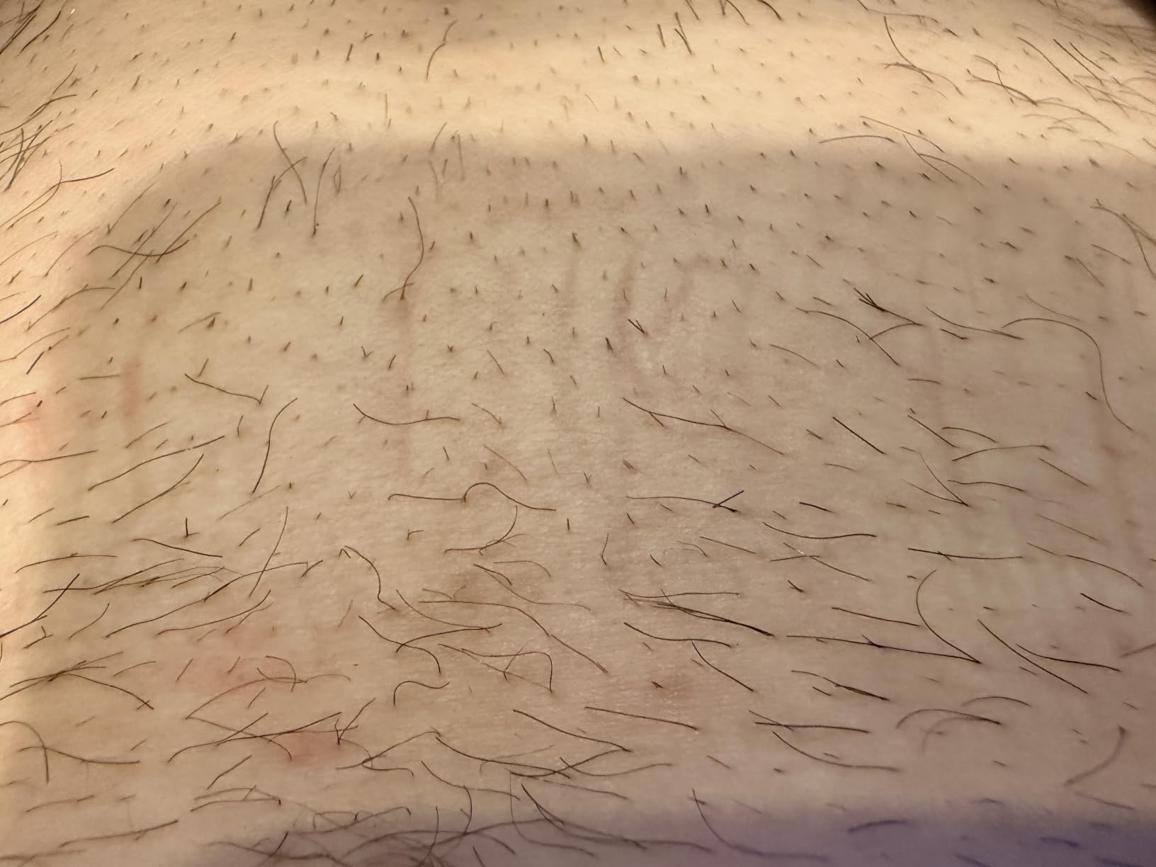 MANSCAPED® The Lawn Mower® 5.0 Ultra Groin & Body Hair Trimmer customer photo 1
