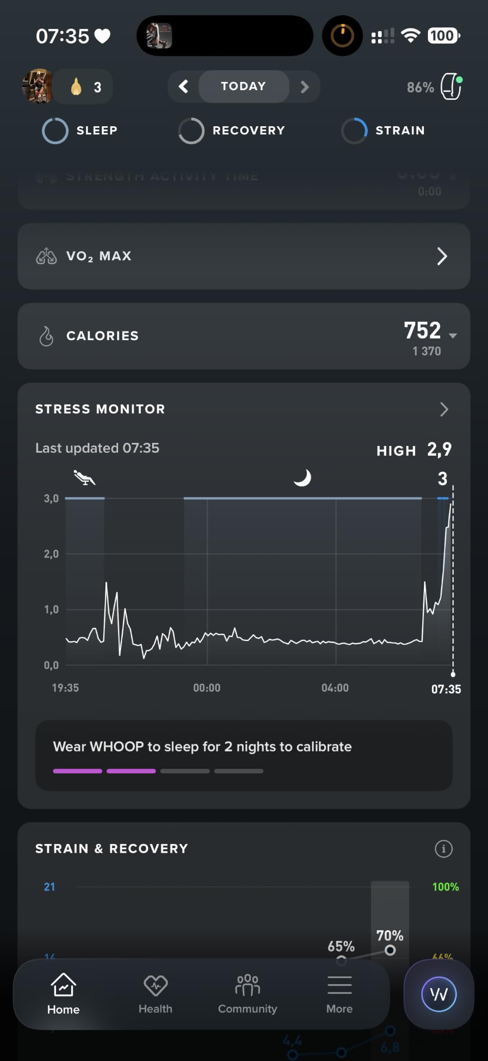 WHOOP 5.0/MG Activity Tracker - 12 Month Membership - Health and Fitness Wearable – 24/7 Activity and Sleep Tracker, Personalized Coaching, Menstrual Cycle Insights – 14+ Days Battery Life customer photo 2